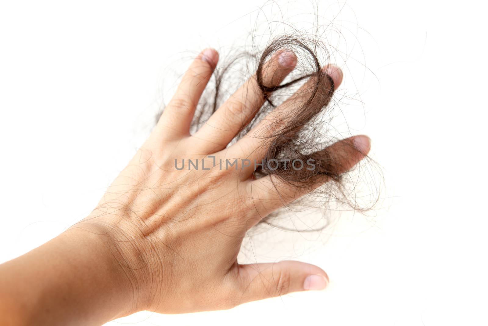 Human hand with lost hair on it, isolated on white background.