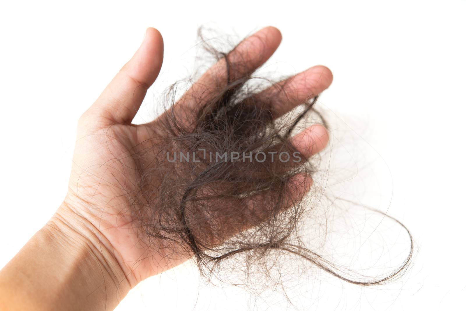 Human hand with lost hair on it, isolated on white background.