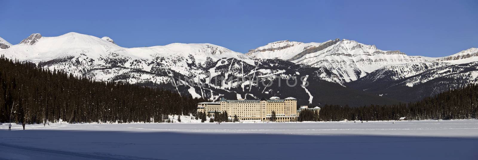 Chateau Lake Louise  by pictureguy