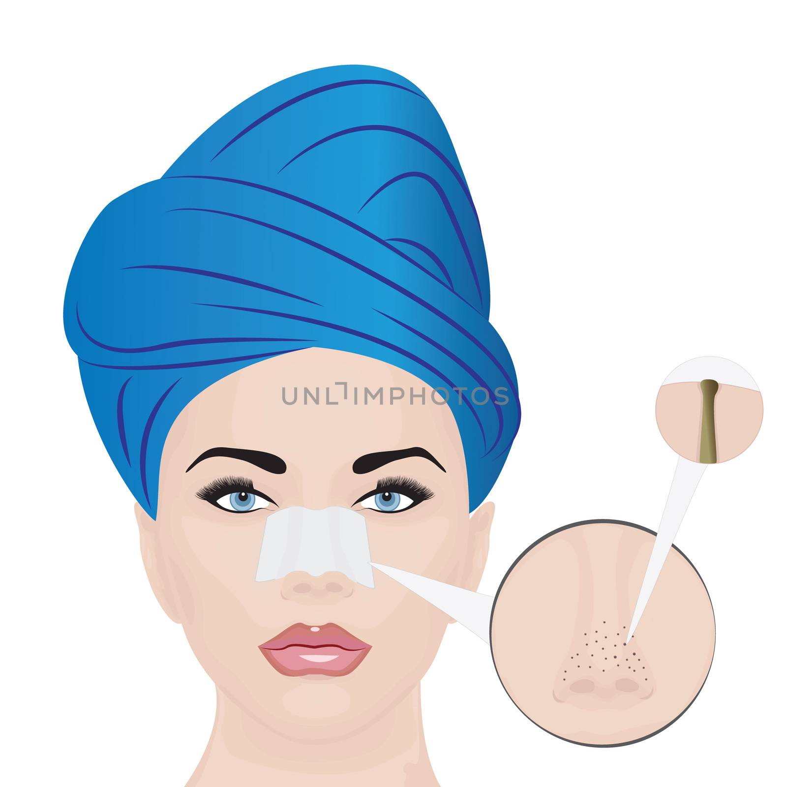 Treatment Blackheads on Nose vector illustration showing skin problems