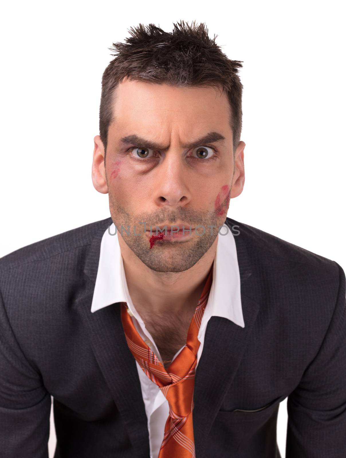 Close up of a businessman with bloody lip, beaten and bruised by michaklootwijk