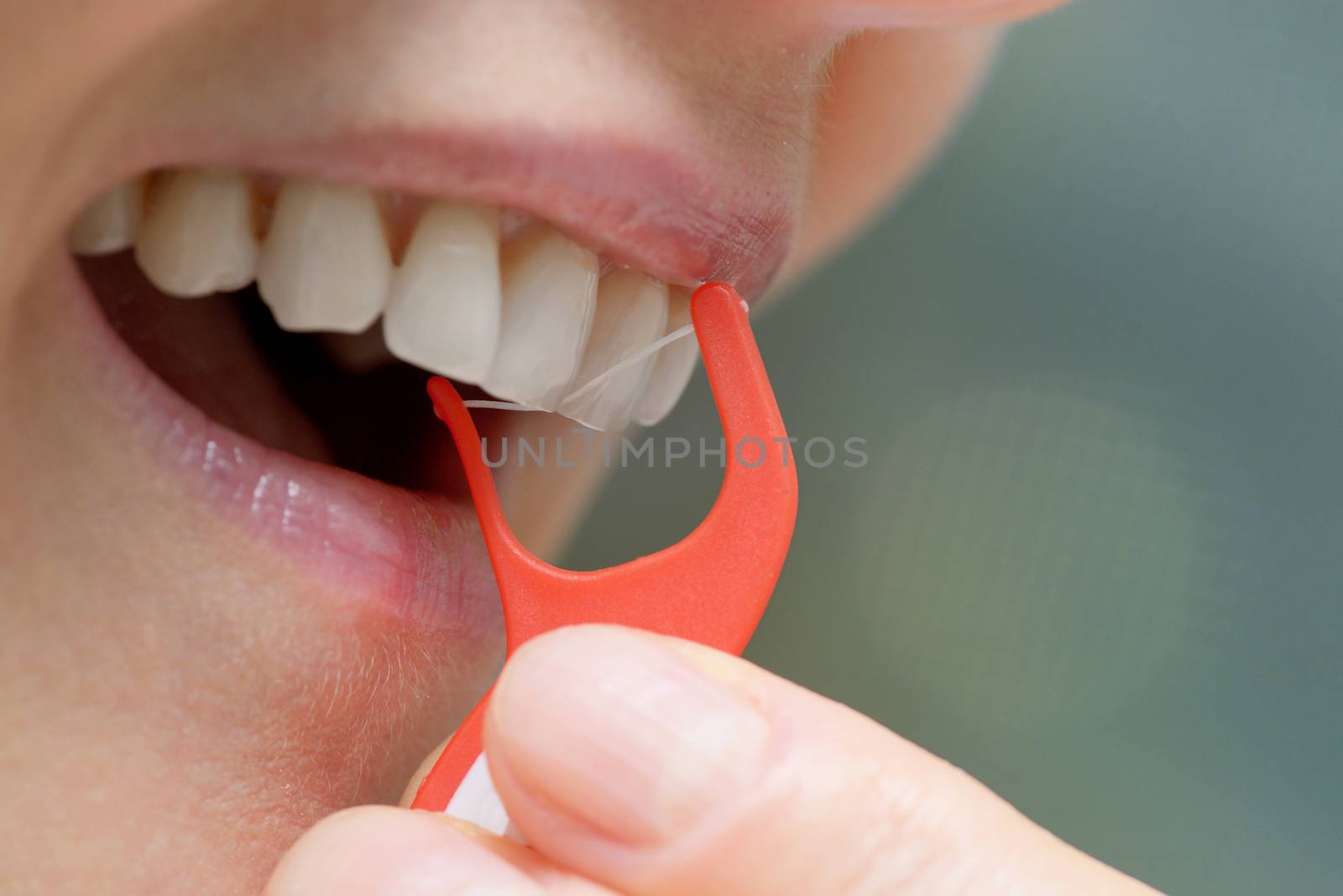 Woman cleaning her teeth with orthodontic flosser by mady70