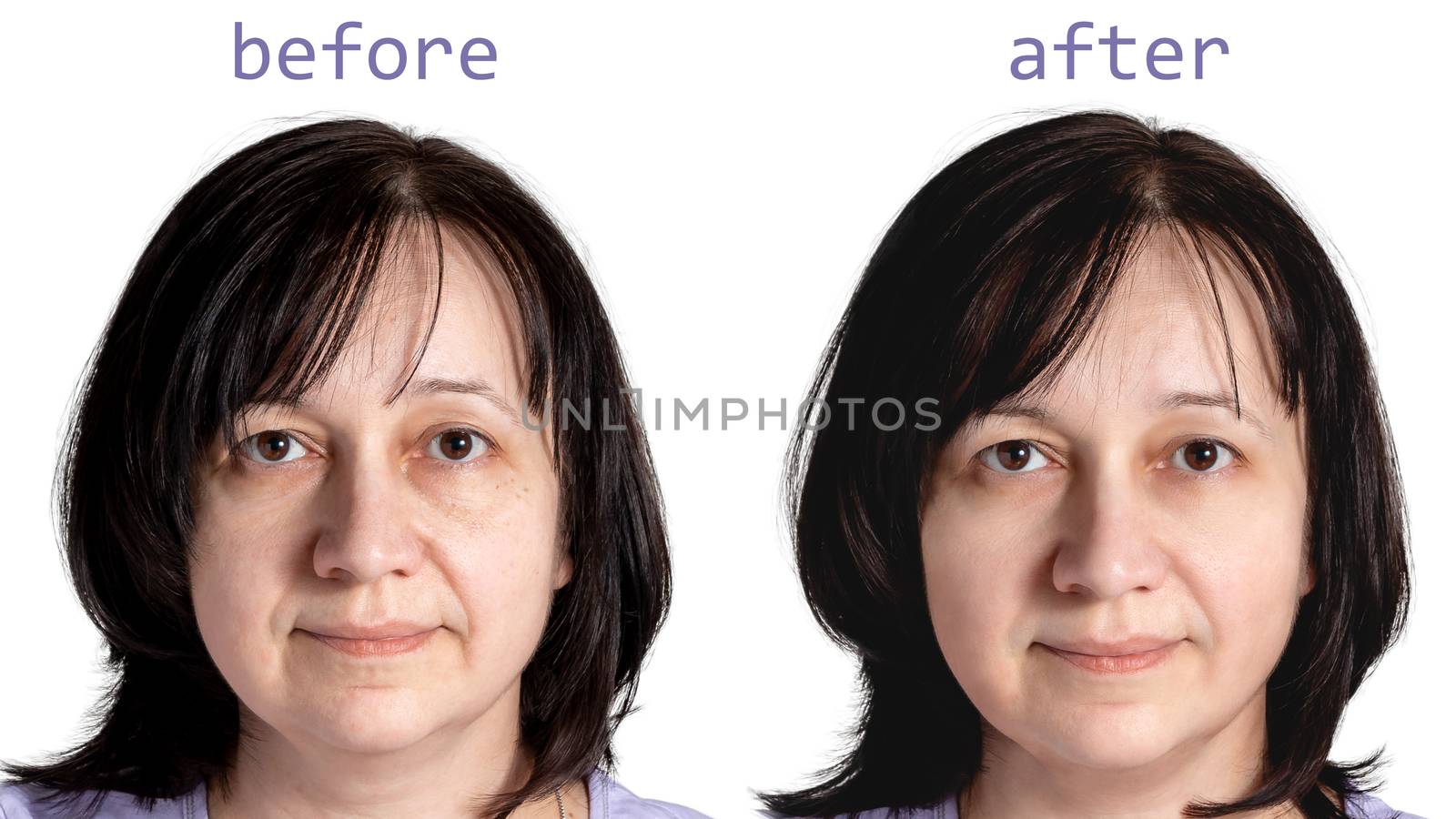 Face of a mature woman with dark hair before and after cosmetic rejuvenating procedures, isolated on white background by galsand