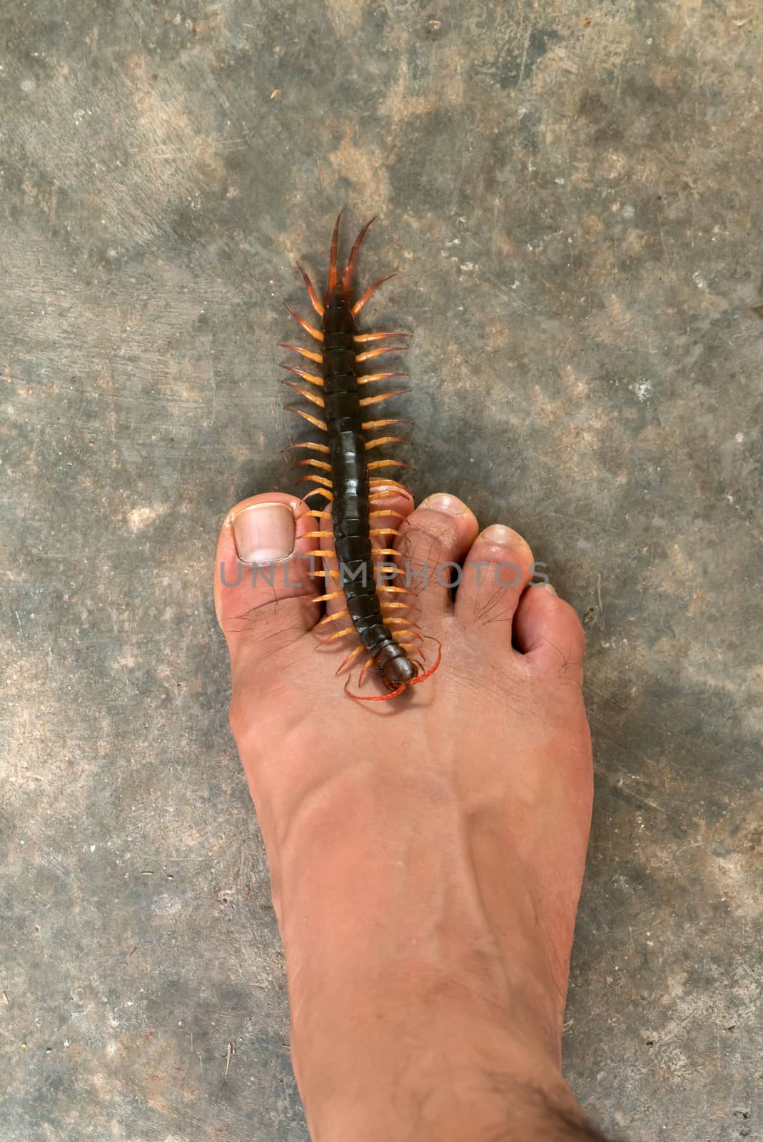 People were bitten by a centipede on feet while walking in their home