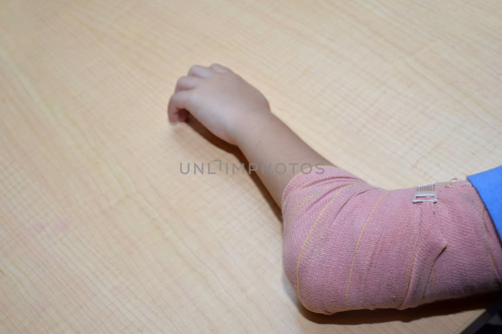 bandaged elbow by antonihalim