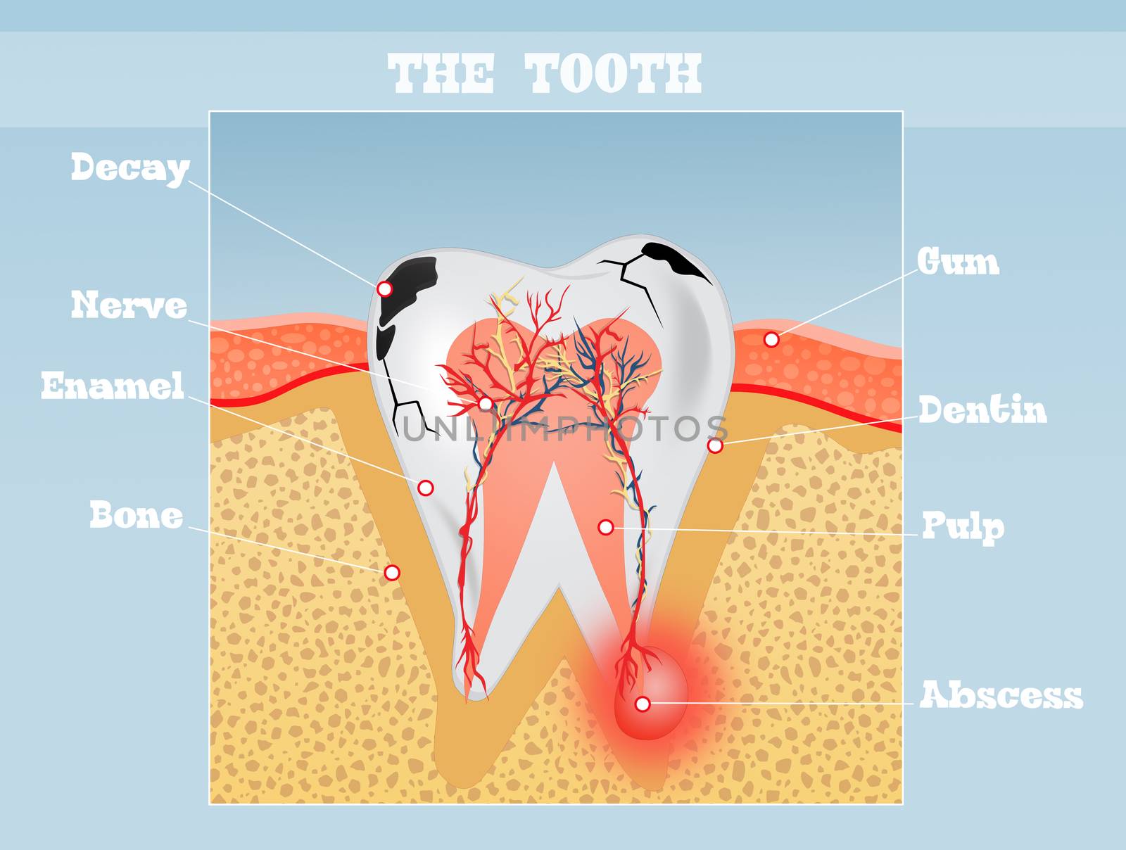 illustration of the tooth scheme