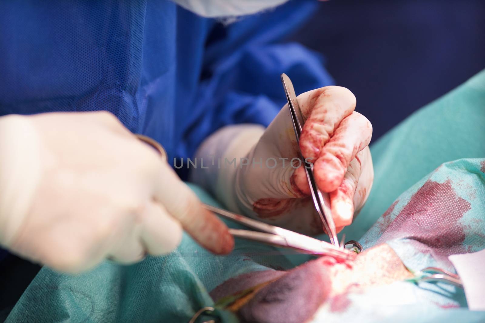 detail of a surgical operation in the surgical room of a hospital by HERRAEZ