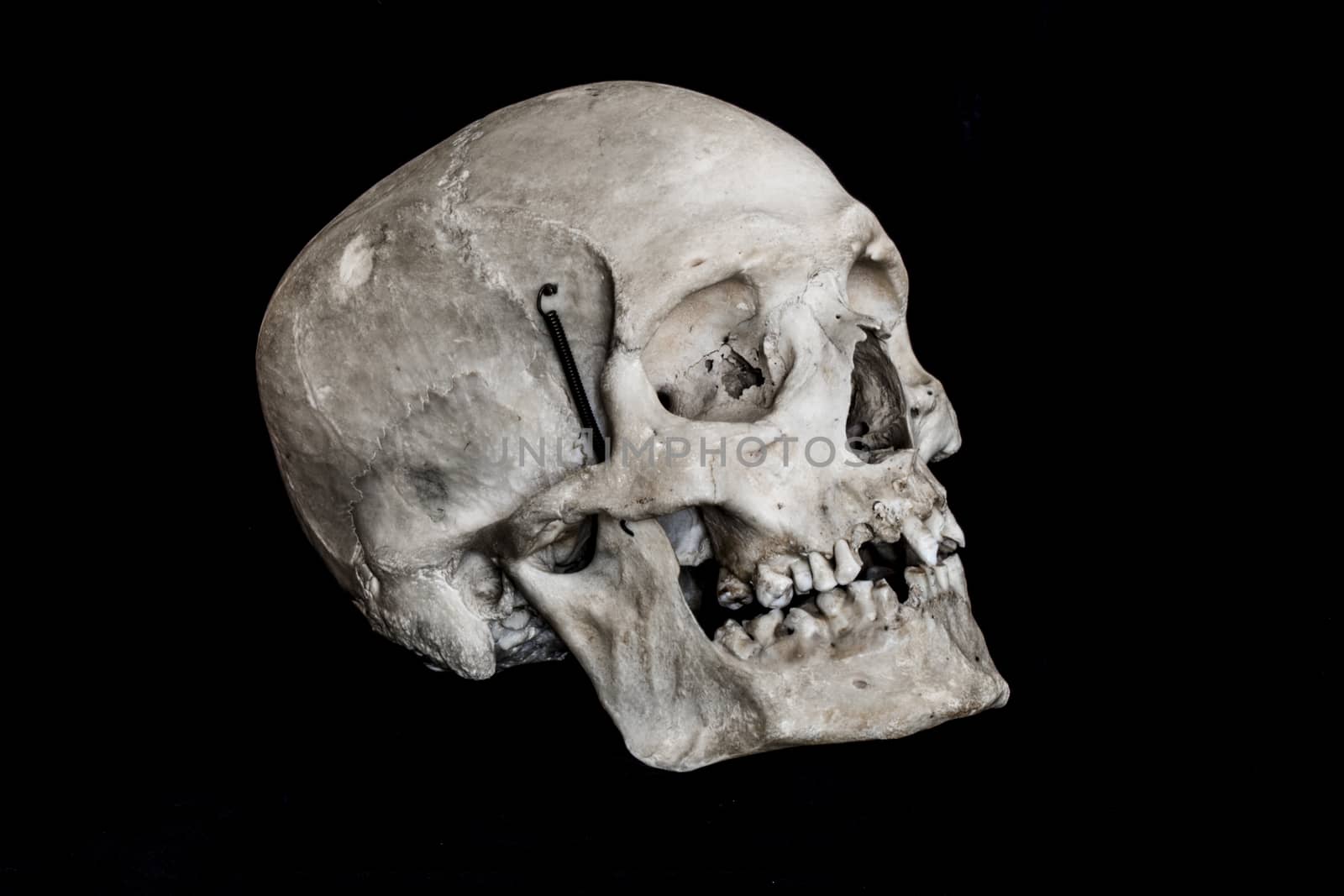 A real human skull on a black background