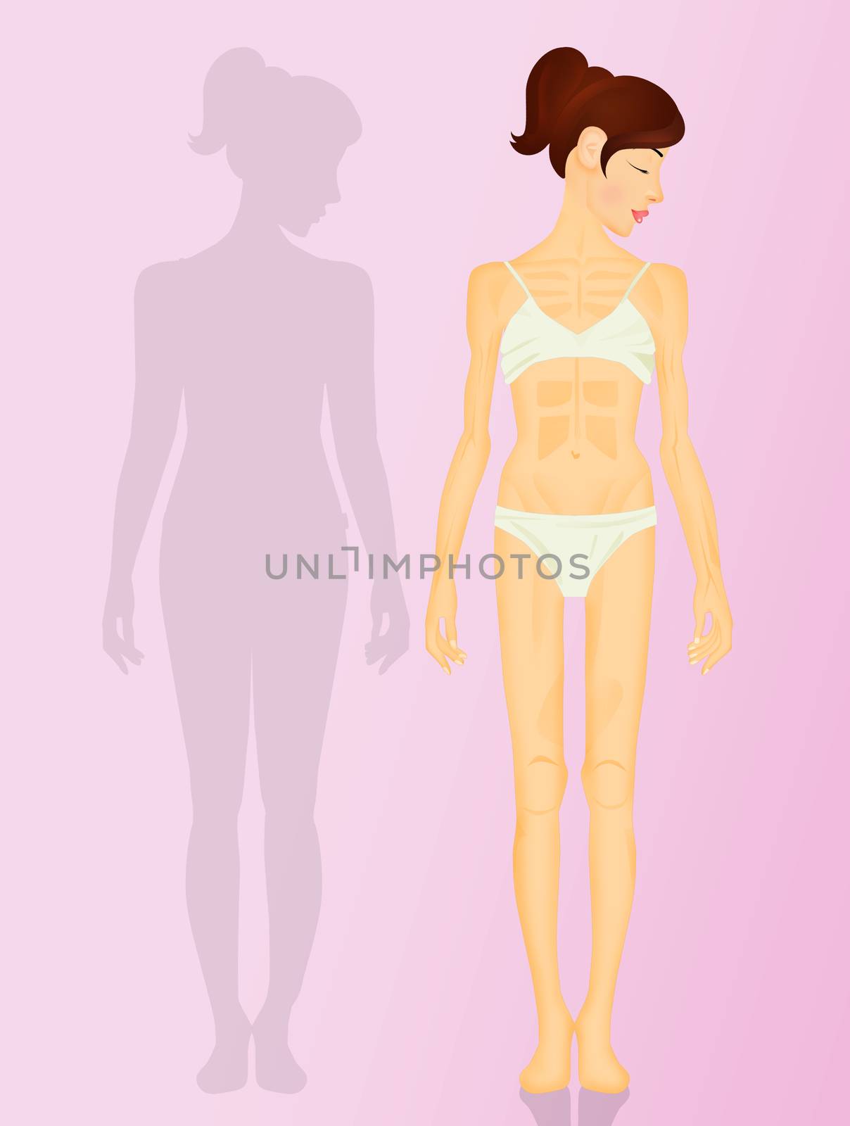 illustration of woman with anorexia