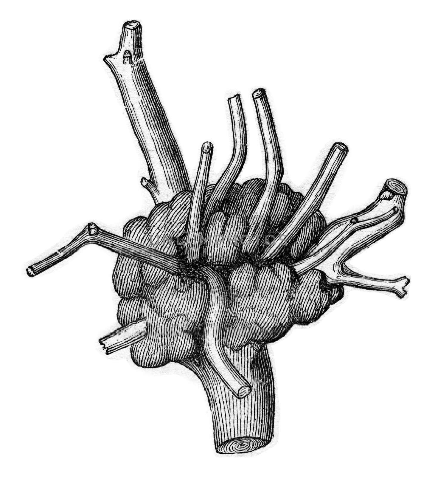 Magnifier produced on Quercus Cerris, at the insertion of an already old foot Loranthus installs parasite., vintage engraved illustration.
