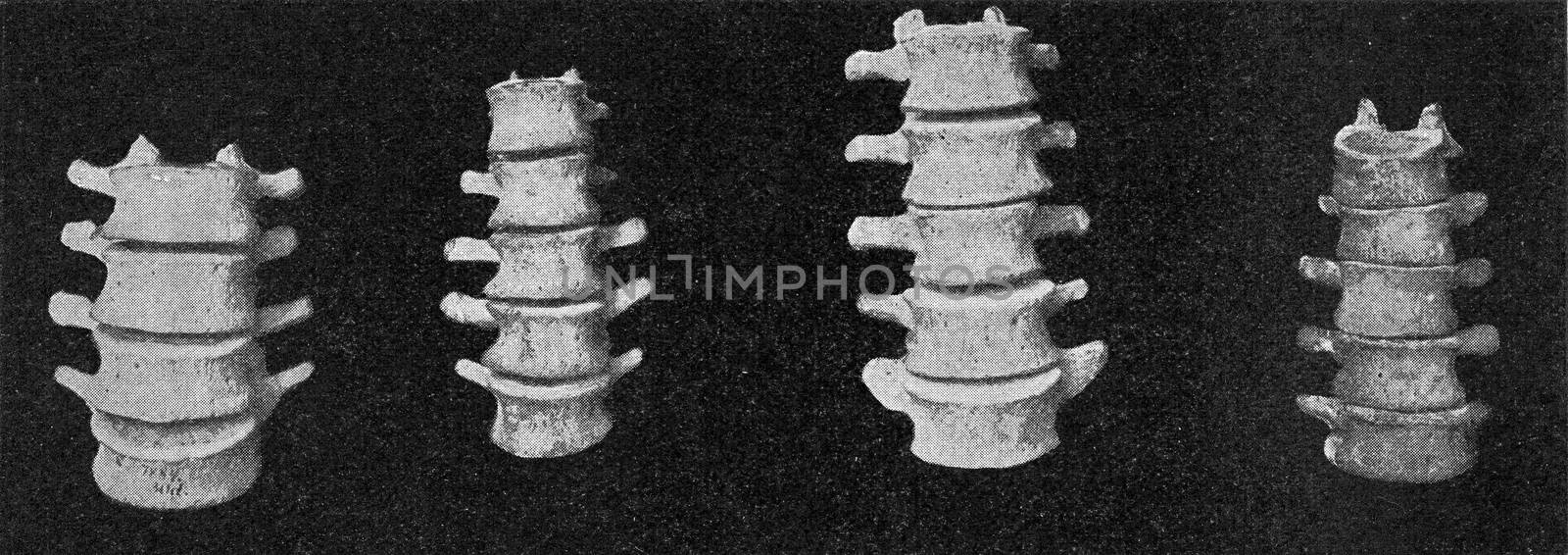 Comparative table of lumbar vertebral columns of a European, an Australian, an African negro and a Dwarf negro of the Philippines, vintage engraved illustration. From the Universe and Humanity, 1910.
