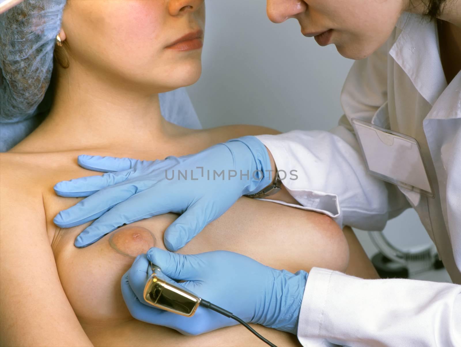 Correction of breast nipples, cosmetic surgery.
