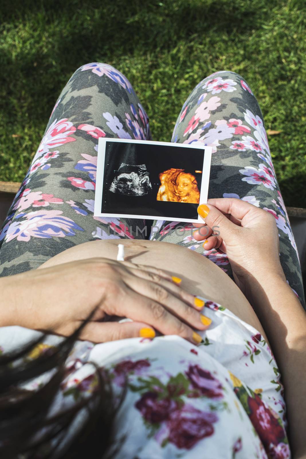 Pregnant women hold picture of womb by deyan_georgiev