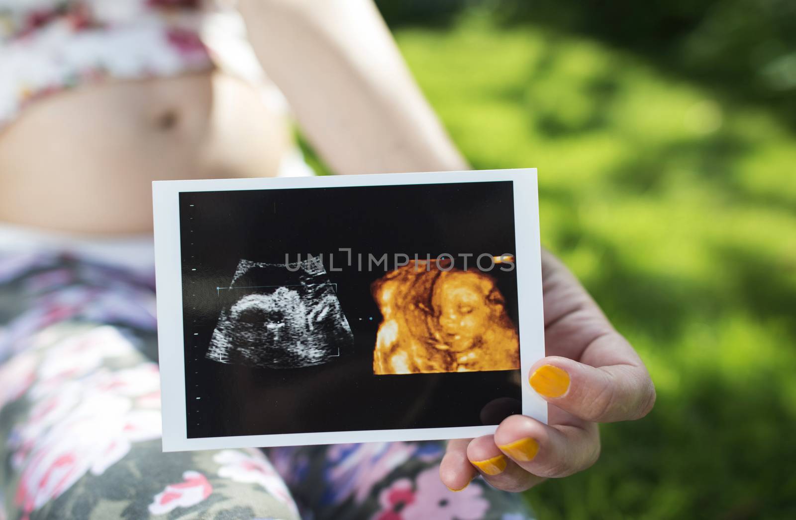 Pregnant women hold picture of womb. Daylight in the garden