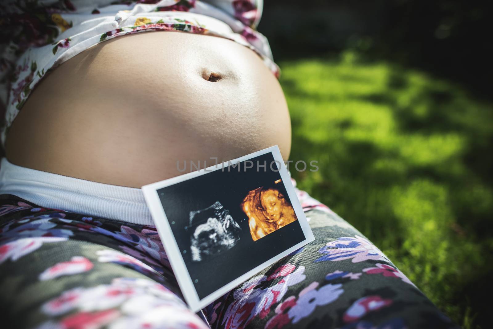 Pregnant women hold picture of womb by deyan_georgiev
