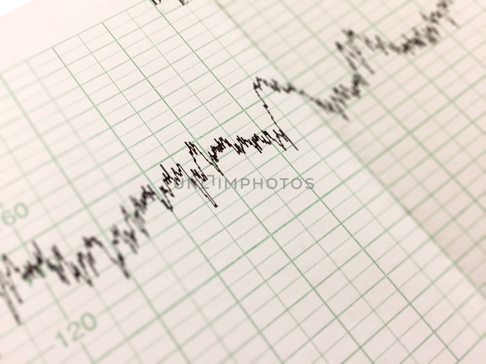 Printing of cardiogram report, electrocardiography, close-up