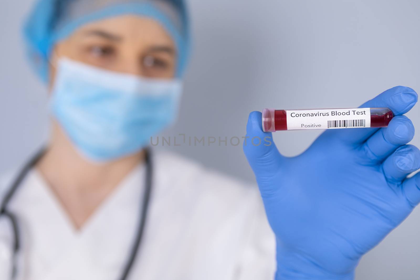 Nurse holding test tube with Positive Coronavirus test blood sample. Virus test and research concept. Focus is on blood test tube.