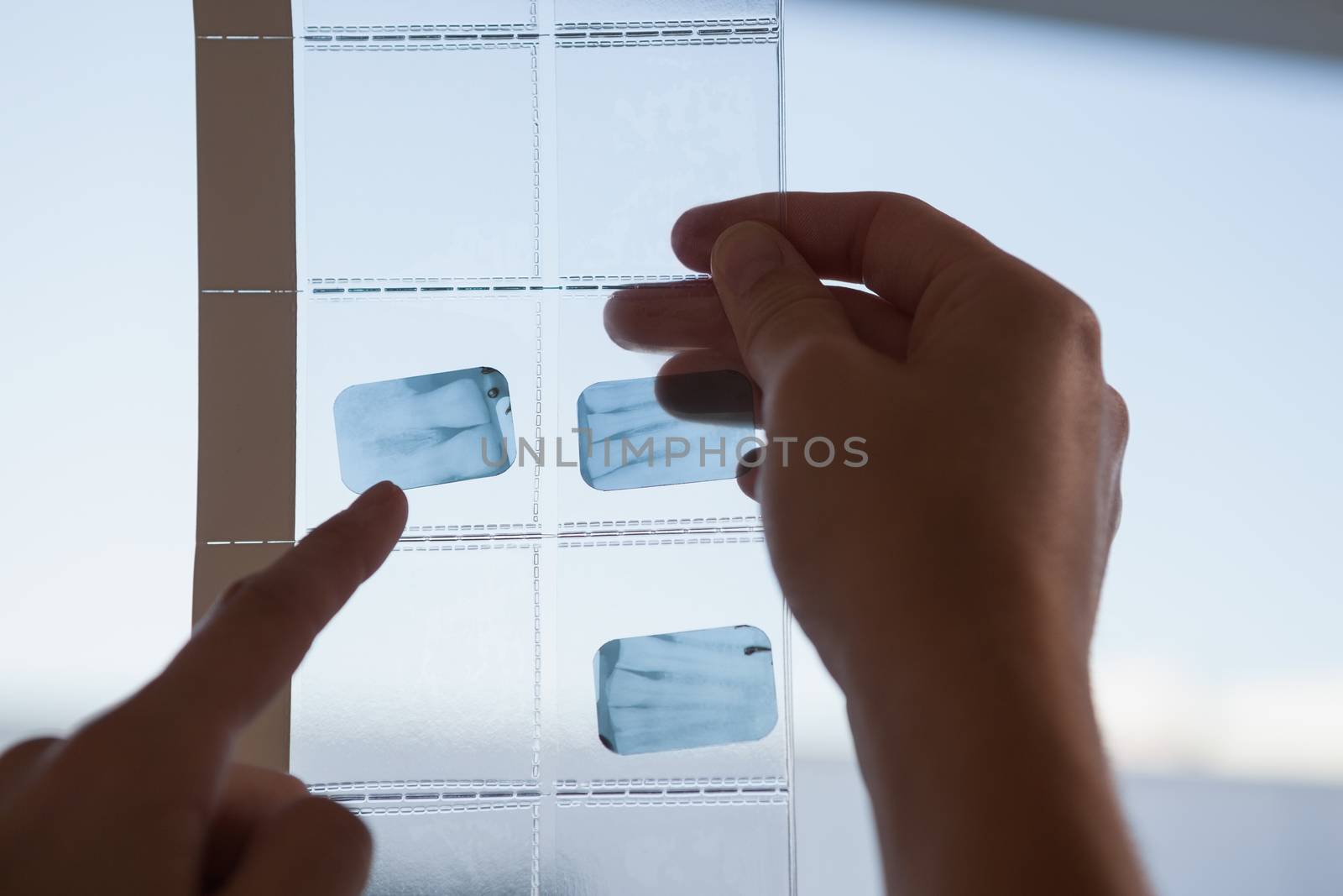 Dentists looking and pointing to xray at the dental clinic