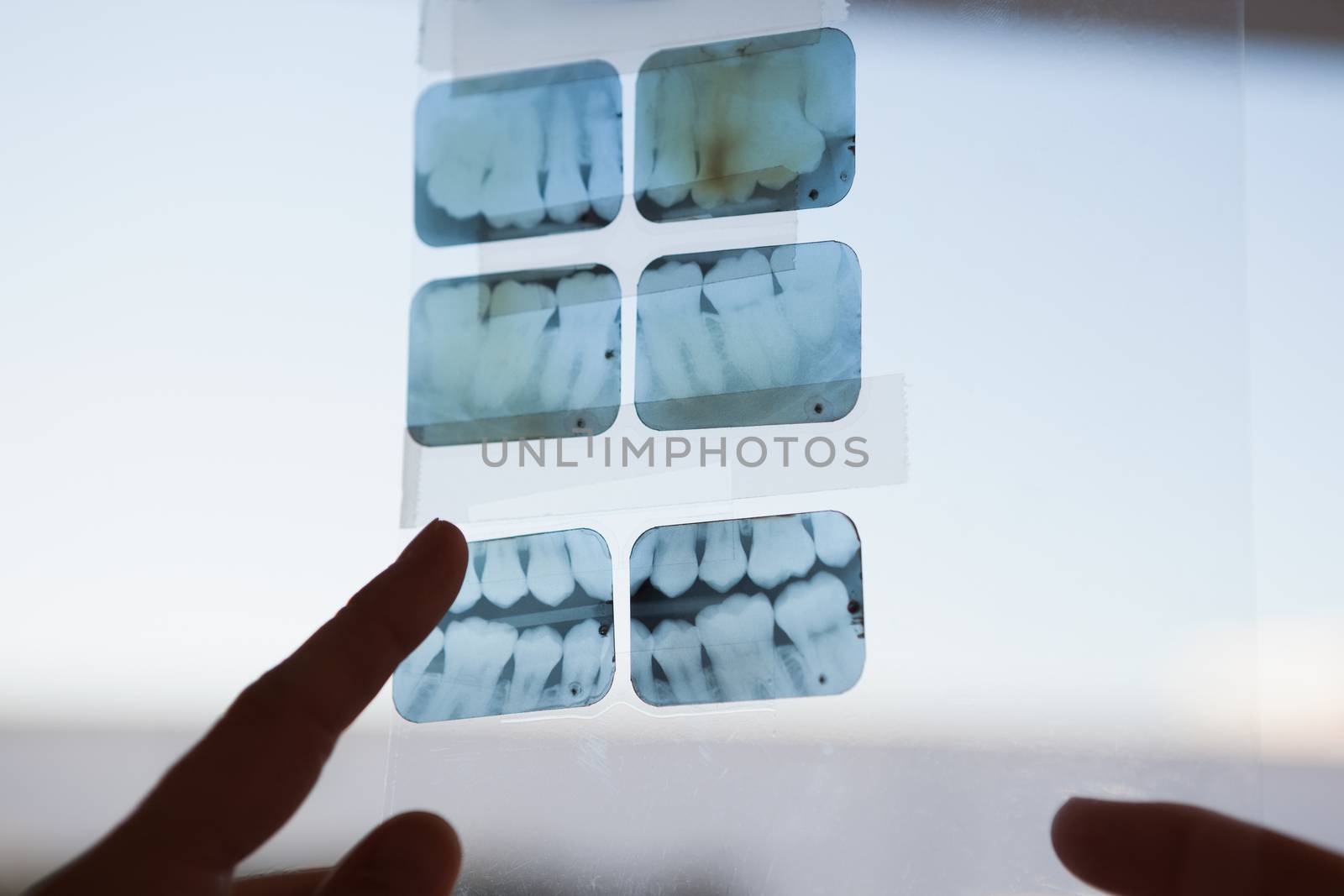 Dentists looking and pointing to xray by Wavebreakmedia