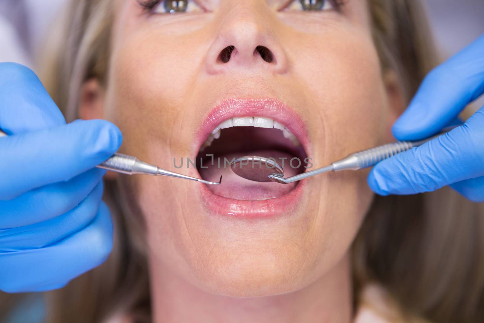 Close up of dentist examining patient at medical clinic