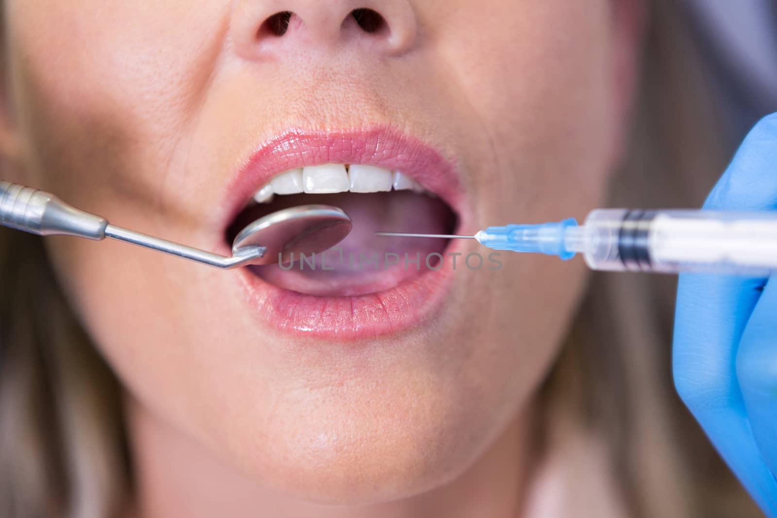 High angle view of dentist holding syringe by patient mouth by Wavebreakmedia