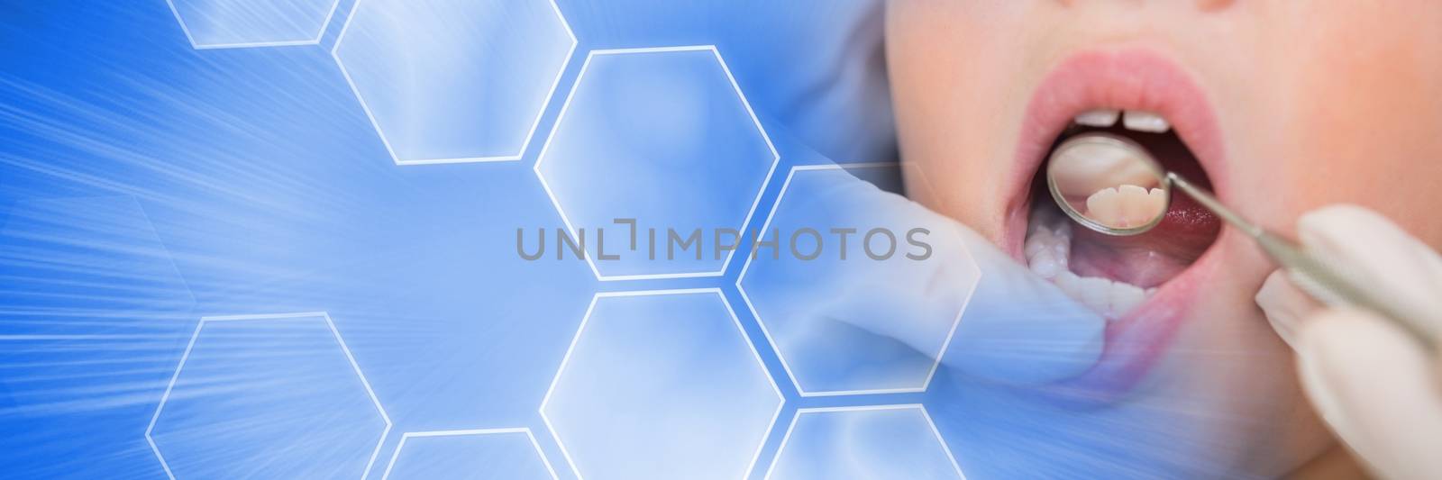 Digital composite of Close up of dentist working on patient's mouth and blue smart tech transition