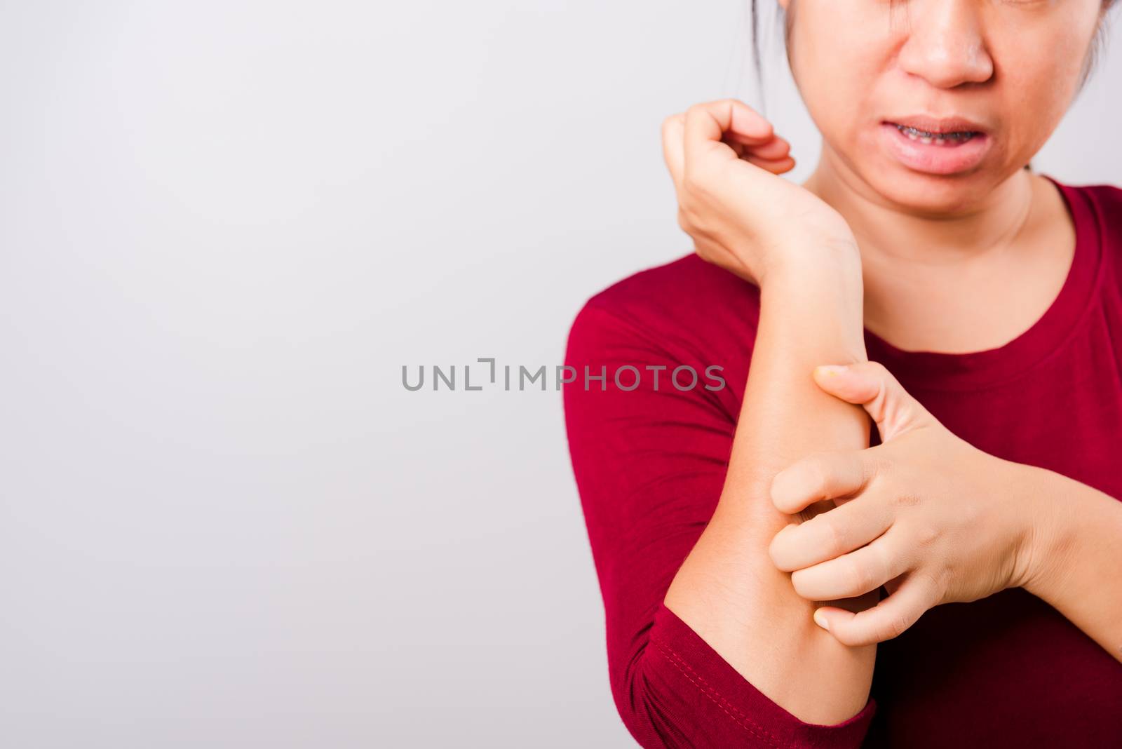 Asian beautiful woman itching her scratching her itchy arm on white background with copy space, Medical and Healthcare concept