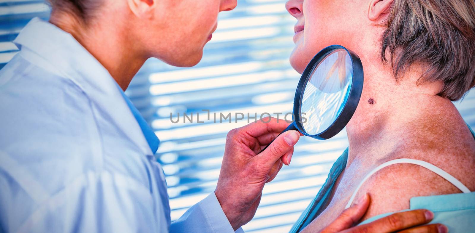 Dermatologist examining mole with magnifying glass in clinic
