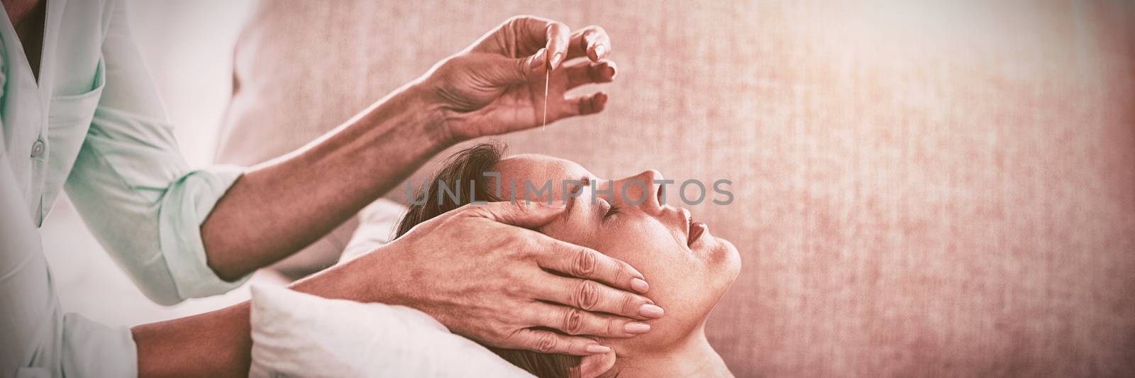 Woman receiving acupuncture treatment at spa