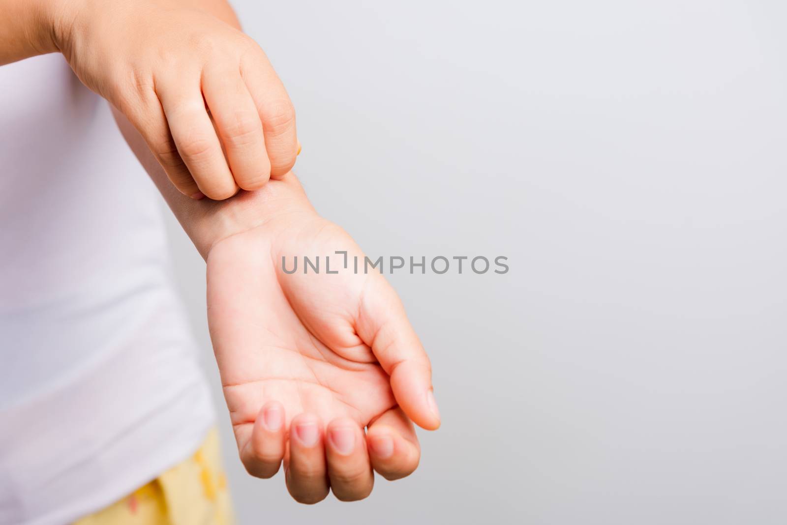 Asian beautiful woman itching her useing hand scratch itch hand on white background with copy space, Medical and Healthcare concept