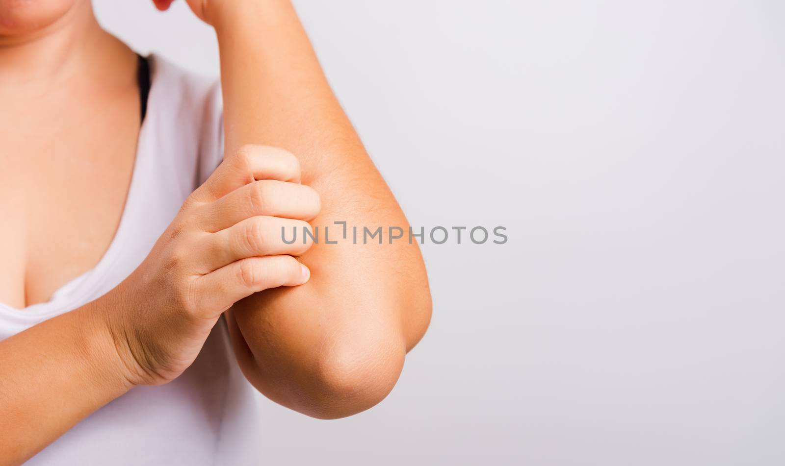 Asian beautiful woman itching her useing hand scratch itch Arm on white background with copy space, Medical and Healthcare concept