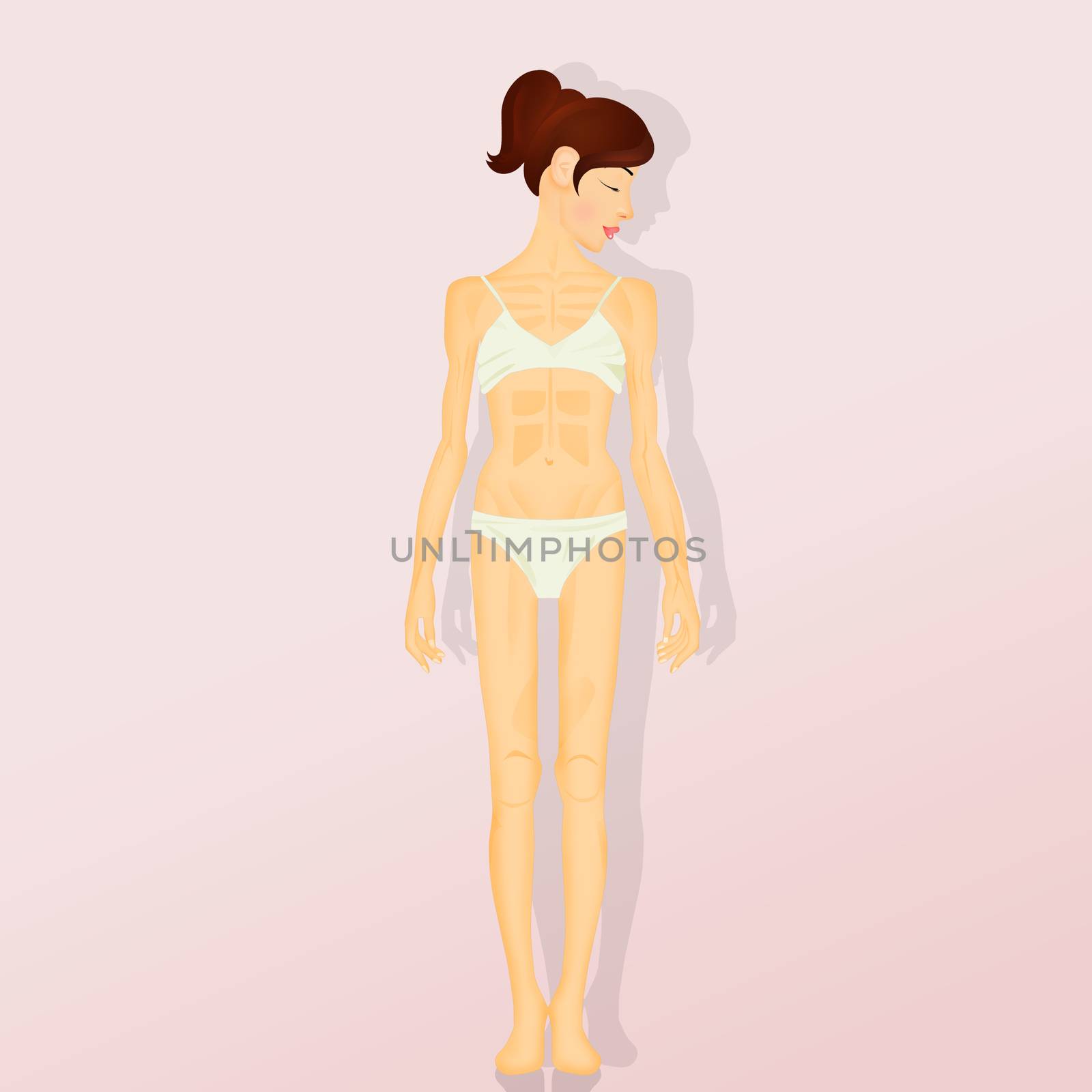 illustration of anorexia