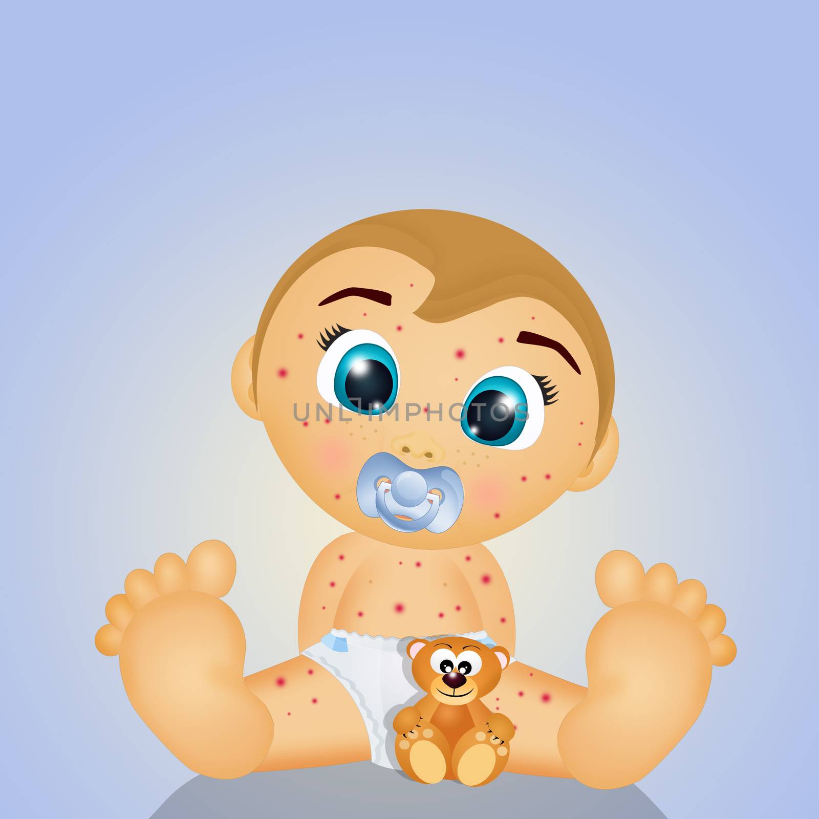 illustration of baby with chicken pox