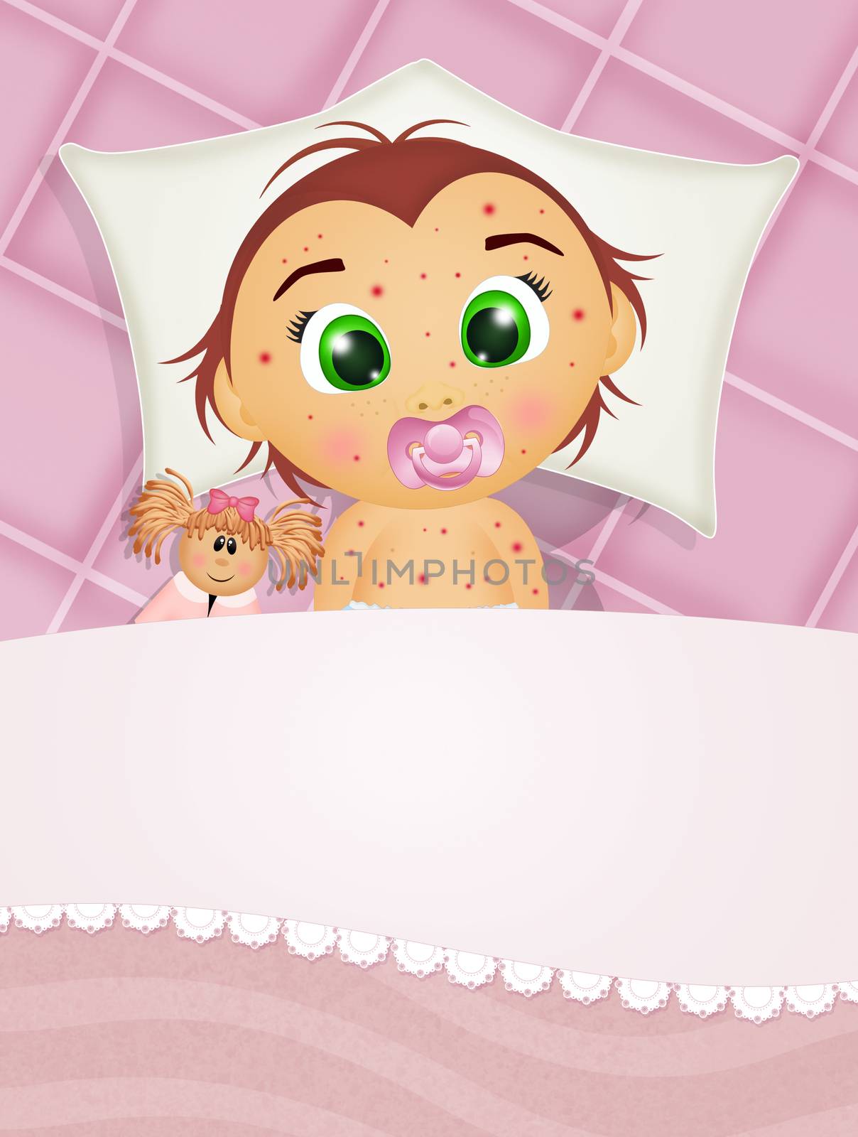 child in bed with measles by adrenalina