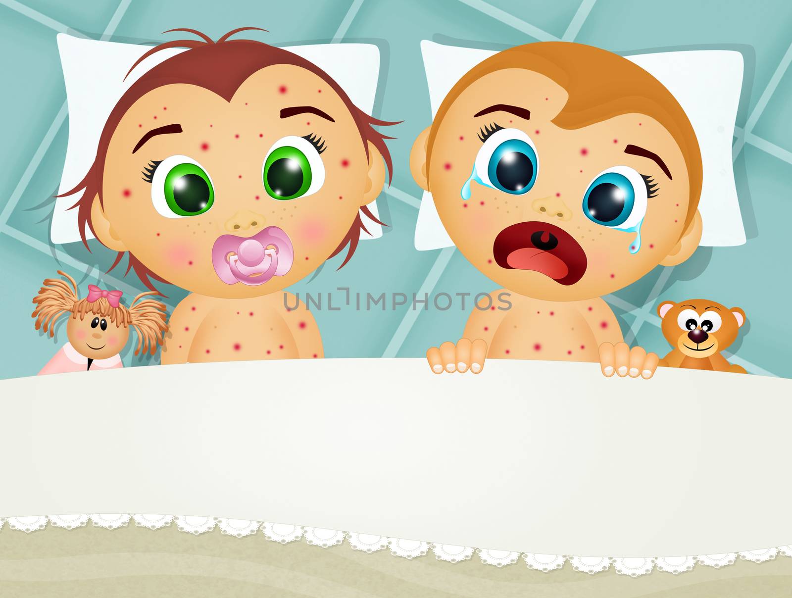 children in bed with measles by adrenalina