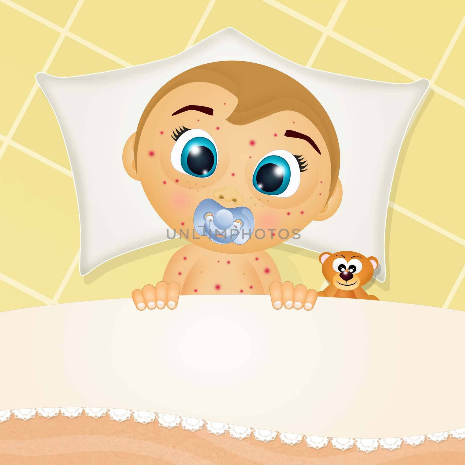 illustration of baby with measles in the bed