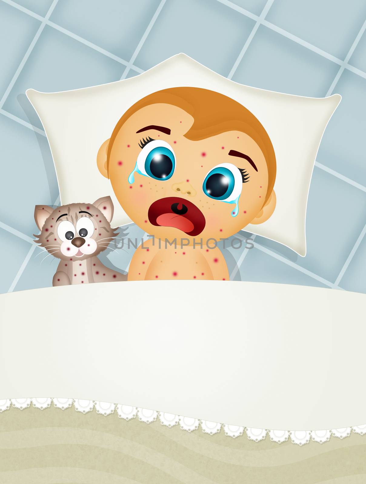 illustration of the baby with chickenpox in the bed
