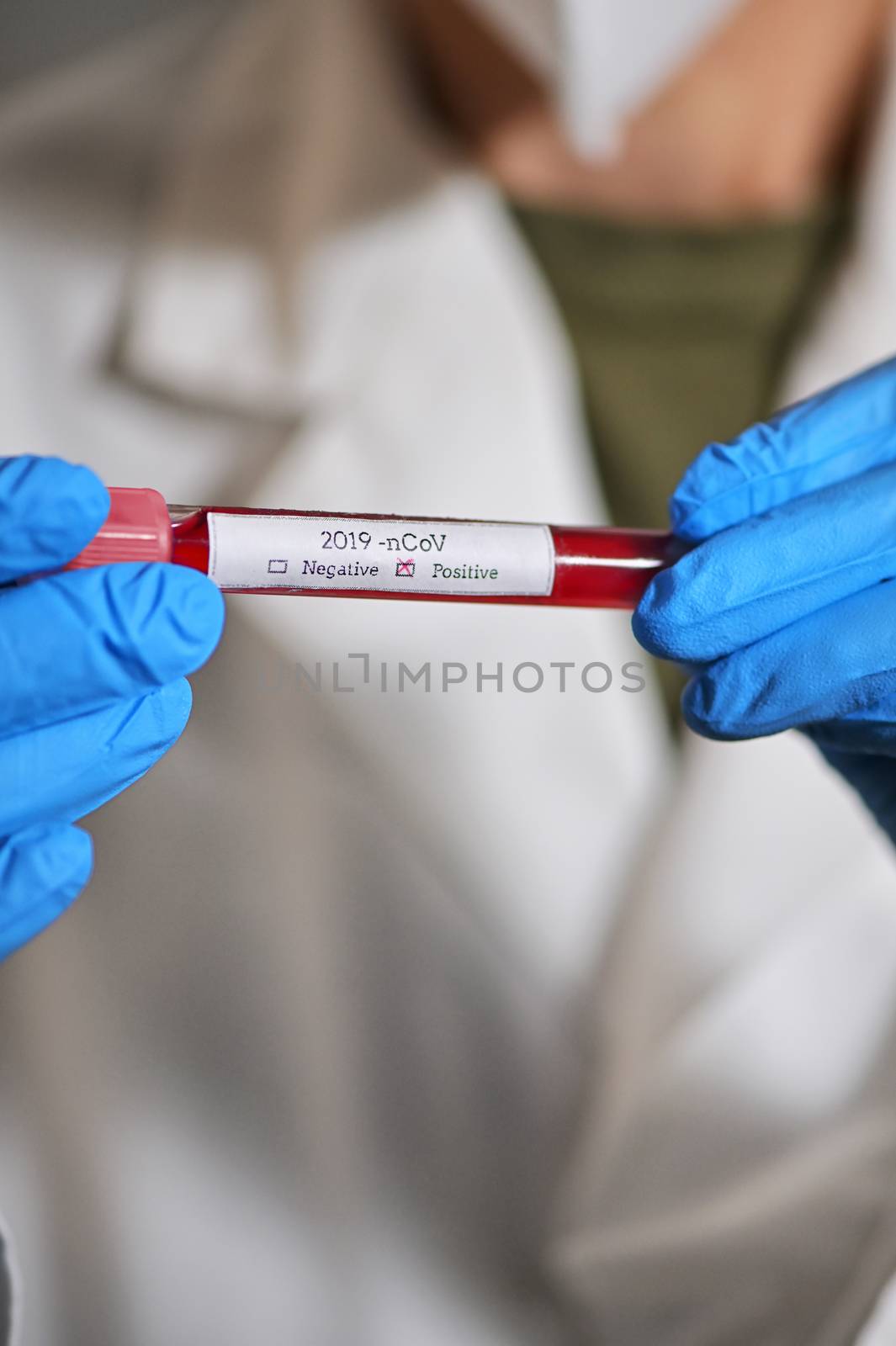 Coronavirus 2019-Ncov With Blood Test by mady70