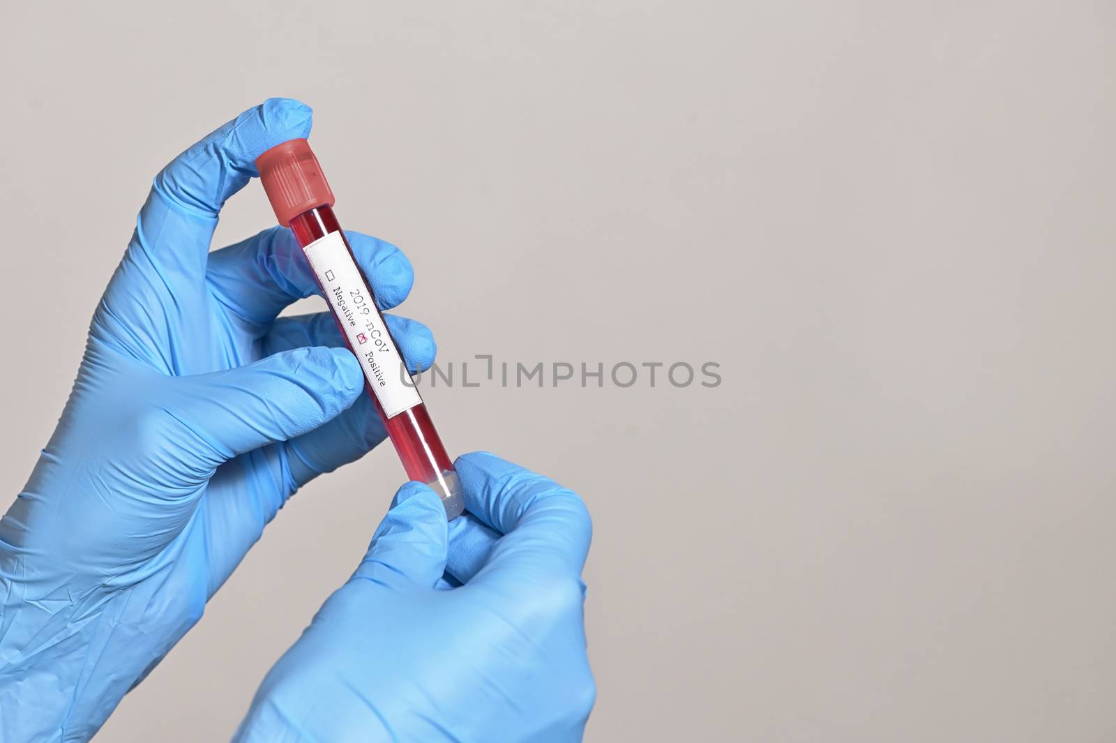 Coronavirus 2019-Ncov With Blood Test by mady70