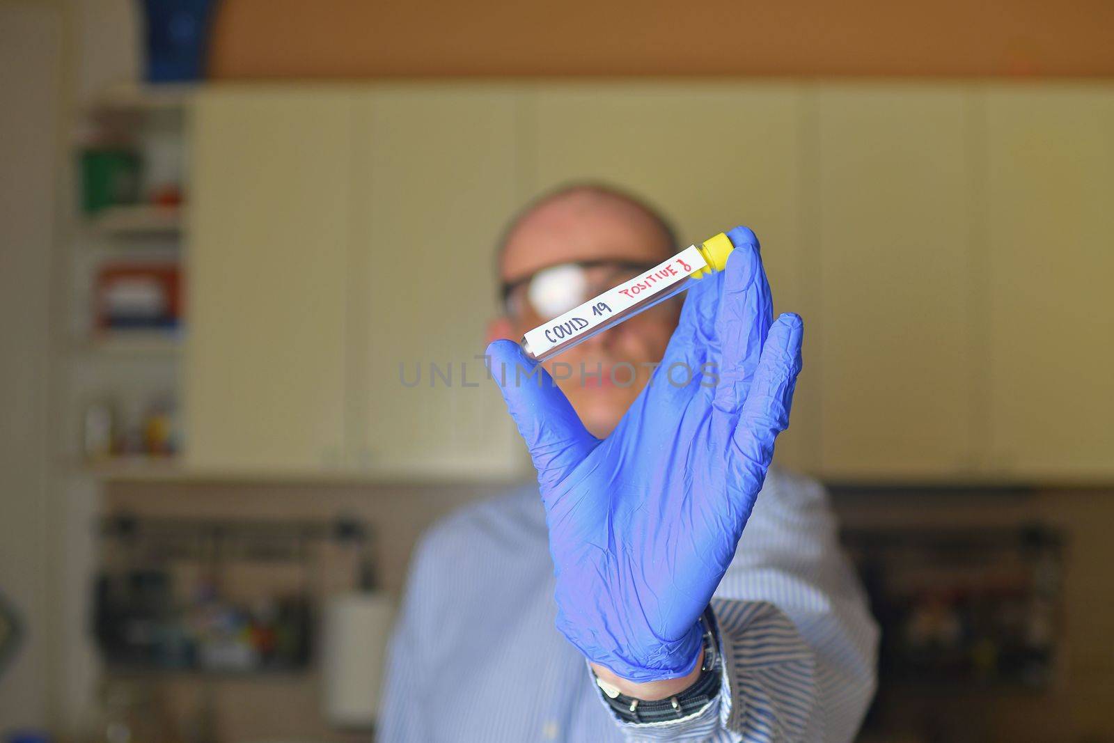 The sample of Covid 19 in the test tube. Doctor - epidemiologist holding thesample tube with sample of coronavirus