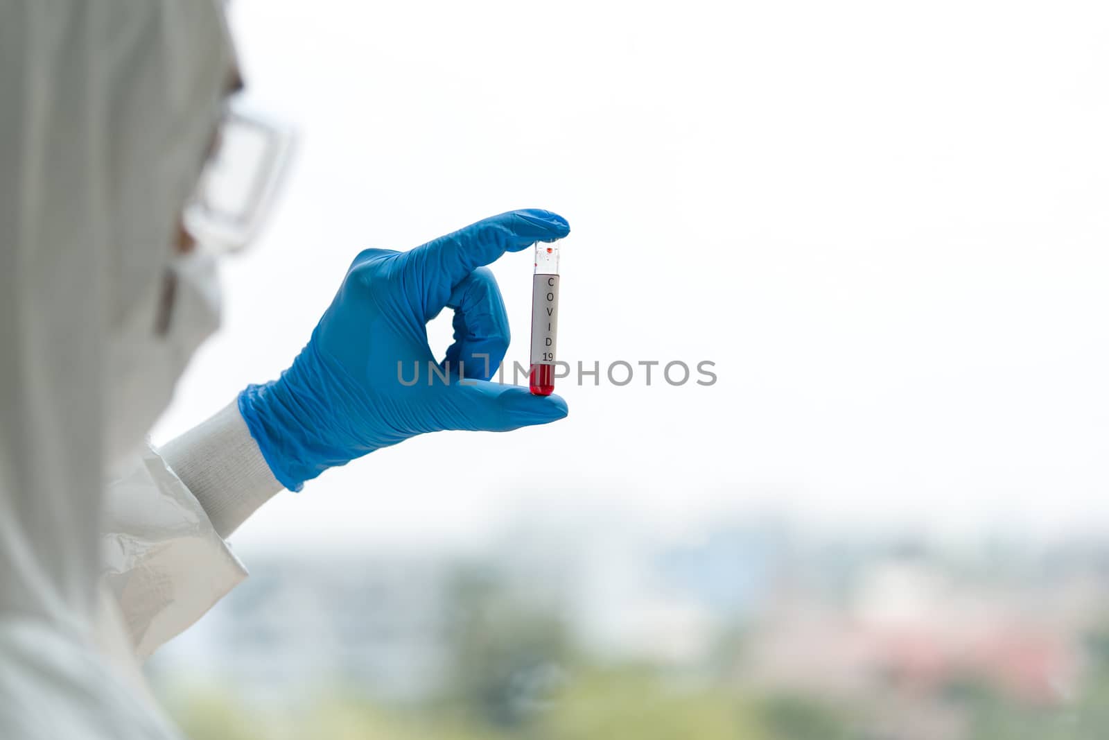 Epidemiological researchers in virus protective clothing are looking at blood samples of patients infected with Covid-19. Coronavirus disease 2019 testing process in a laboratory.
