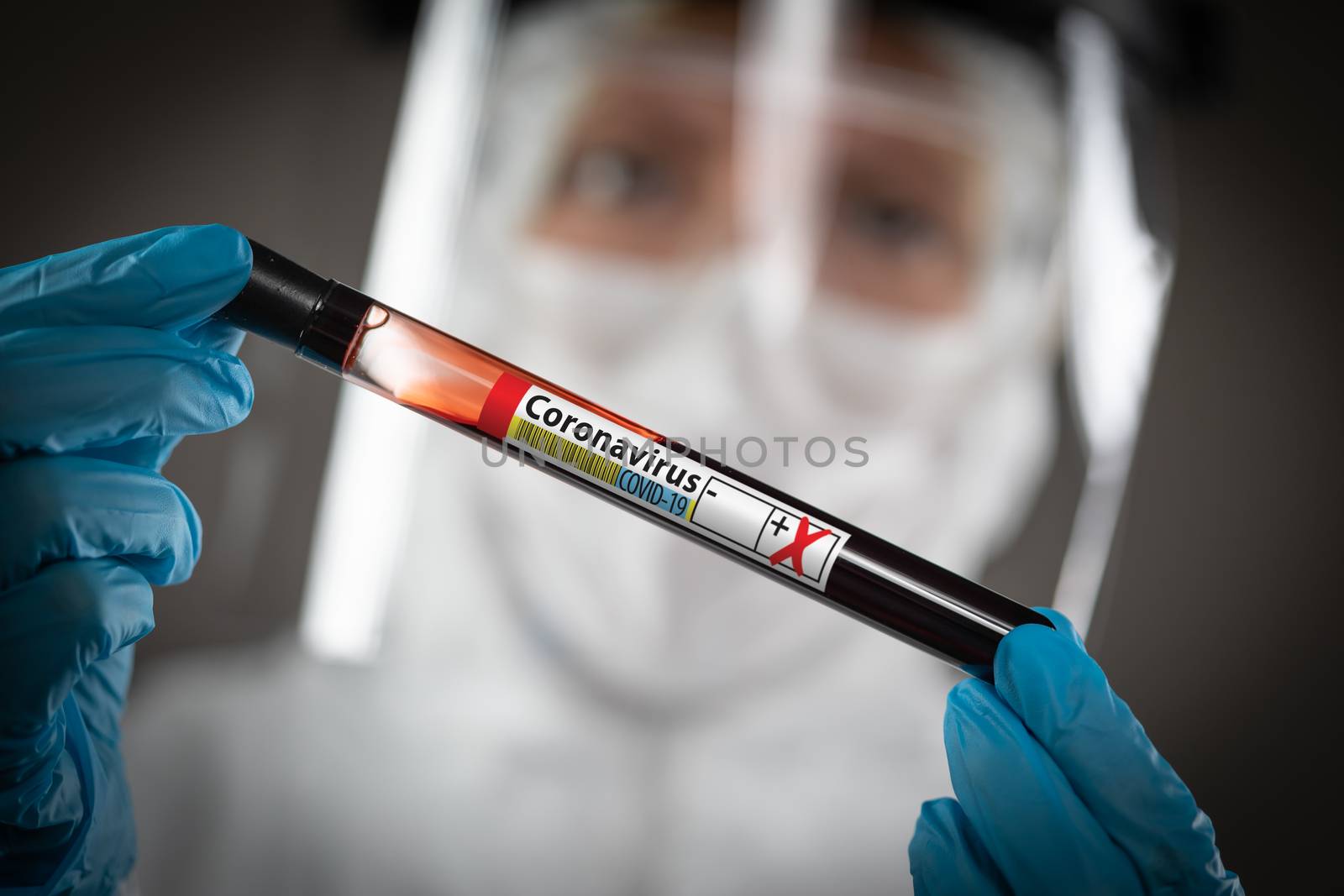Female Lab Worker Holds Test Tube of Blood Labeled Coronavirus COVID-19 Disease. by Feverpitched