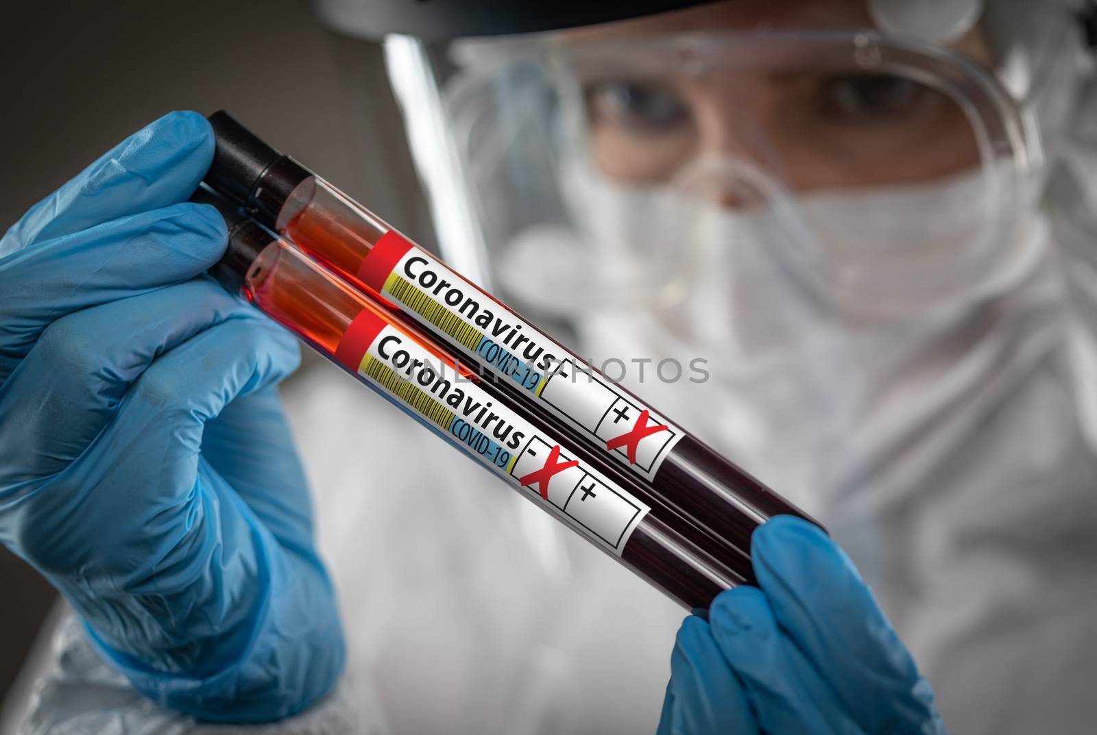 Female Lab Worker Holds Test Tubes of Blood Labeled Coronavirus COVID-19 Disease. by Feverpitched
