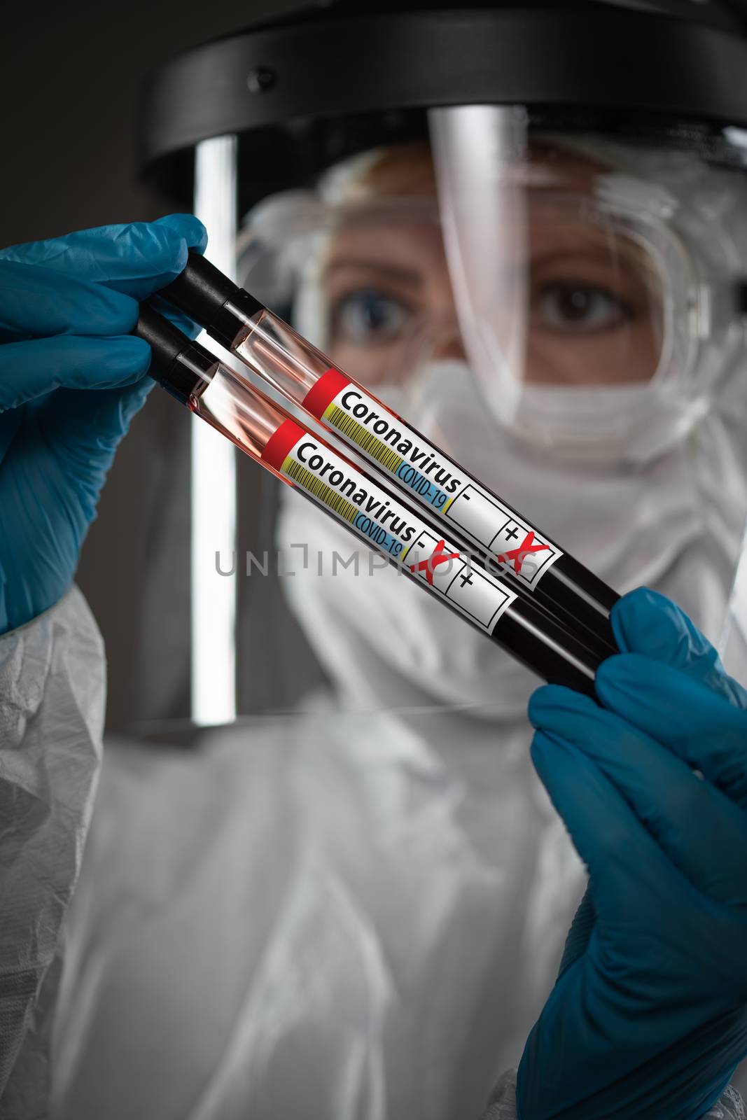 Female Lab Worker Holds Test Tubes of Blood Labeled Coronavirus COVID-19 Disease. by Feverpitched