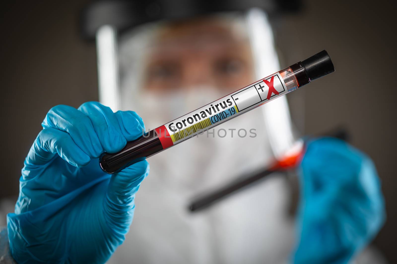 Female Doctor or Nurse Holding Test Tube of Blood Labeled Positive for Coronavirus COVID-19 Disease. by Feverpitched
