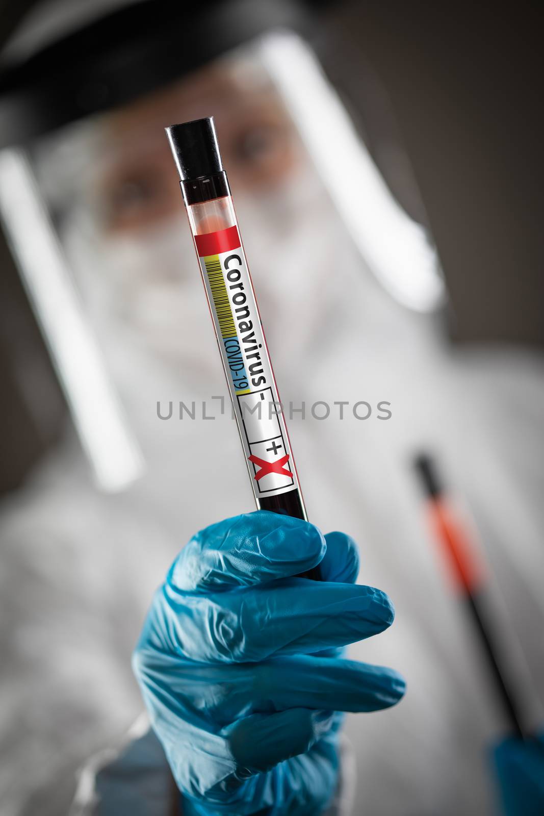 Female Doctor or Nurse Holding Test Tube of Blood Labeled Positive for Coronavirus COVID-19 Disease. by Feverpitched