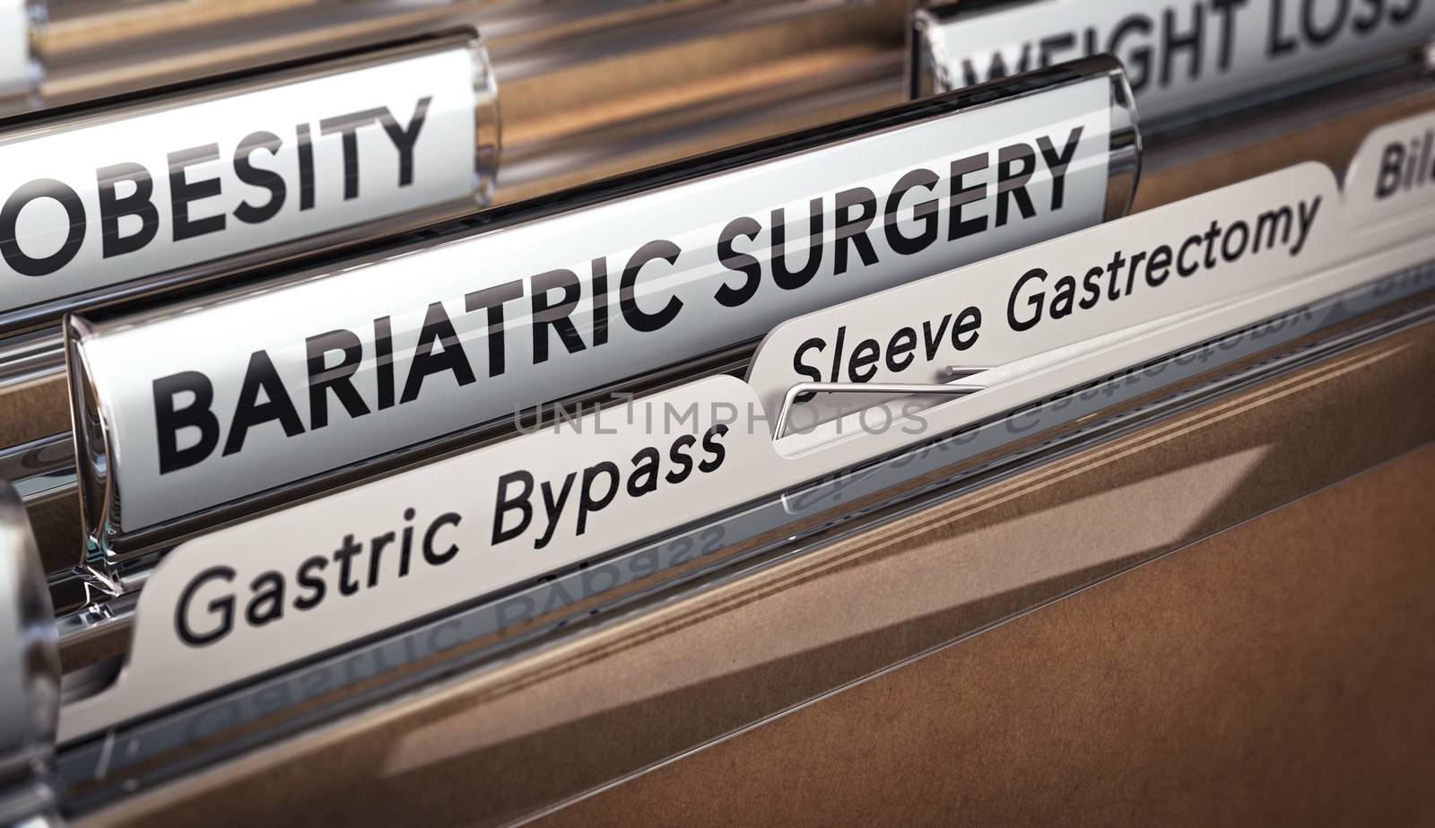 Bariatric Surgery Types, Gastric Bypass Or Sleeve Gastrectomy. by Olivier-Le-Moal