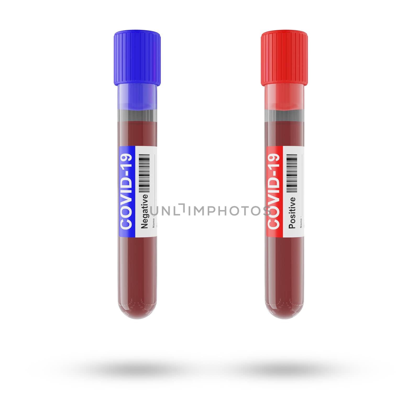 Blood and plasma in test tubes that have been analyzed for COVID-19, 2019-ncov or coronavirus to find a way to stop pandemic. Blue tube, result Negative and Red tube, result positive in laboratory.