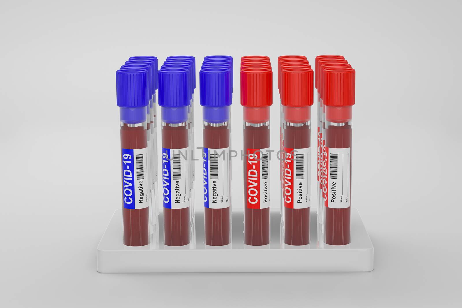 Blood and plasma in test tubes that have been analyzed for COVID-19, 2019-ncov or coronavirus to find a way to stop pandemic. Blue tube, result Negative and Red tube, result positive in laboratory.