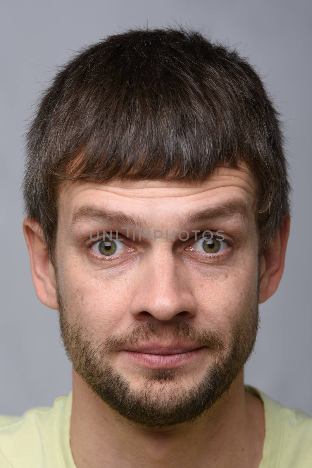 Close-up portrait of a man with bulging eyes of European appearance